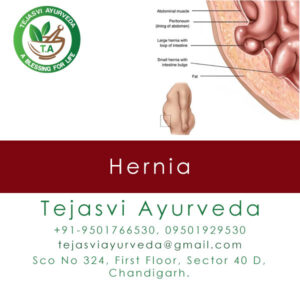Hernia Treatment in Chandigarh
